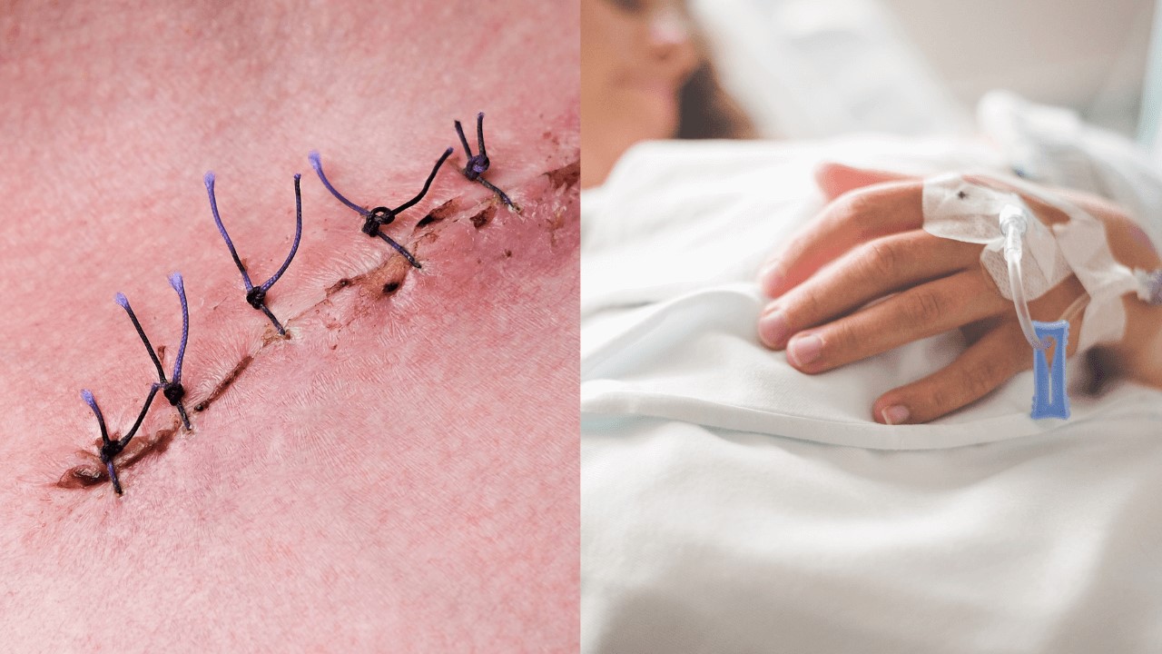 鋅可以改善痘痘嗎?鋅可以修復傷口嗎?掉髮吃鋅嗎? 鋅可以改善痘痘嗎?鋅可以修復傷口嗎?掉髮吃鋅嗎?