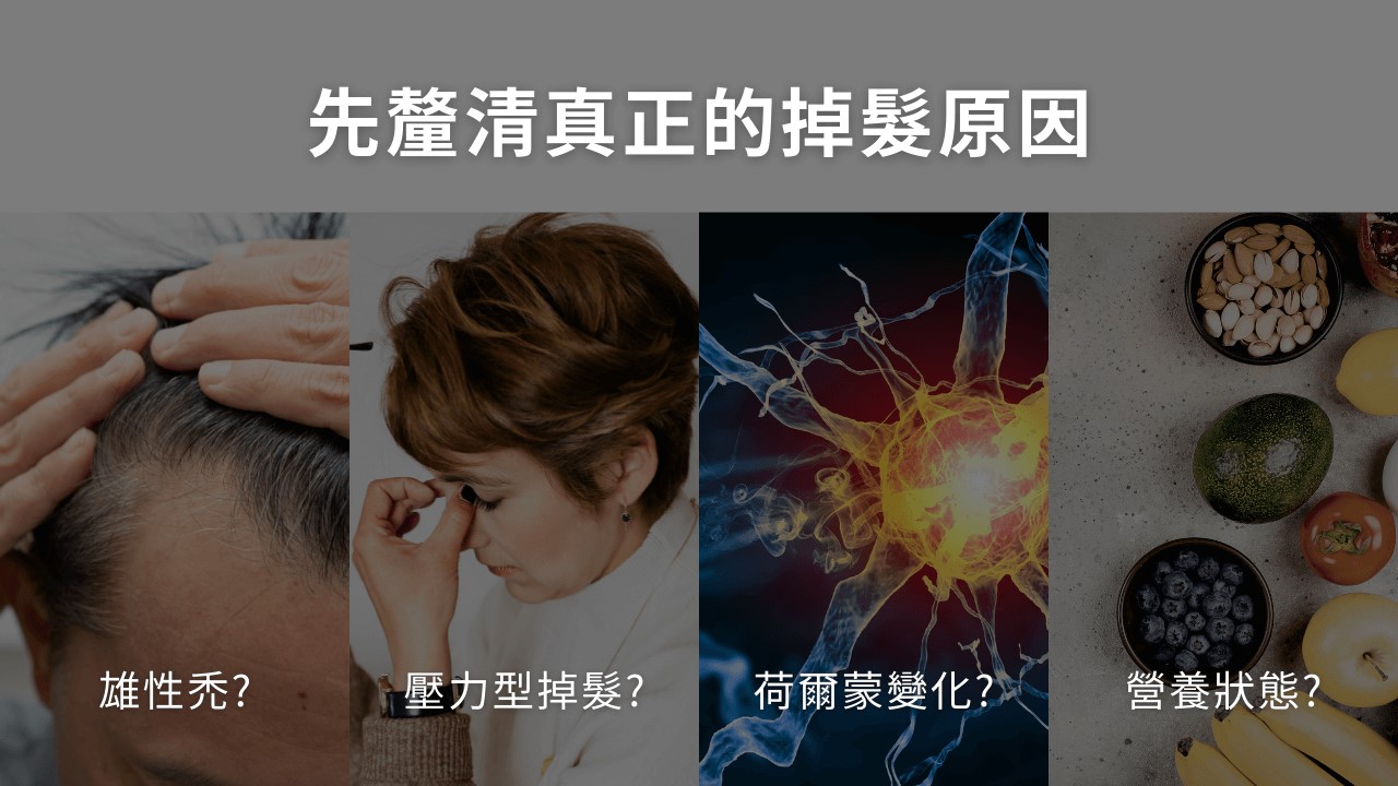 鋅可以改善痘痘嗎?鋅可以修復傷口嗎?掉髮吃鋅嗎? 鋅可以改善痘痘嗎?鋅可以修復傷口嗎?掉髮吃鋅嗎?
