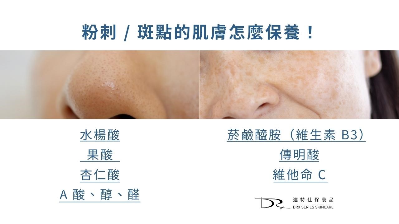 凡士林可以清粉刺嗎？