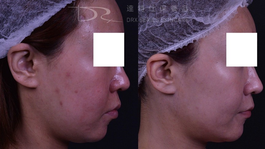 保養品效果怎麼看？過期還能用嗎？正確保養順序一次看！