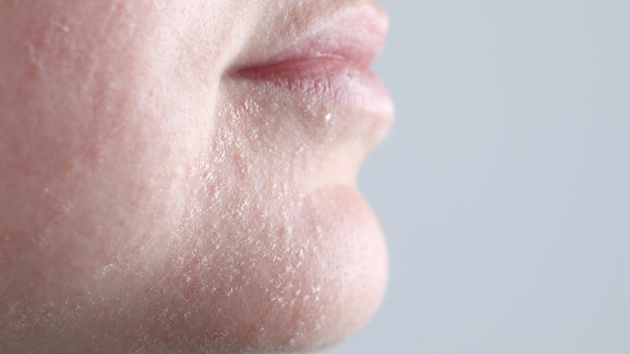 擦A酸脫皮還要擦嗎? 擦A酸脫皮還要擦嗎?