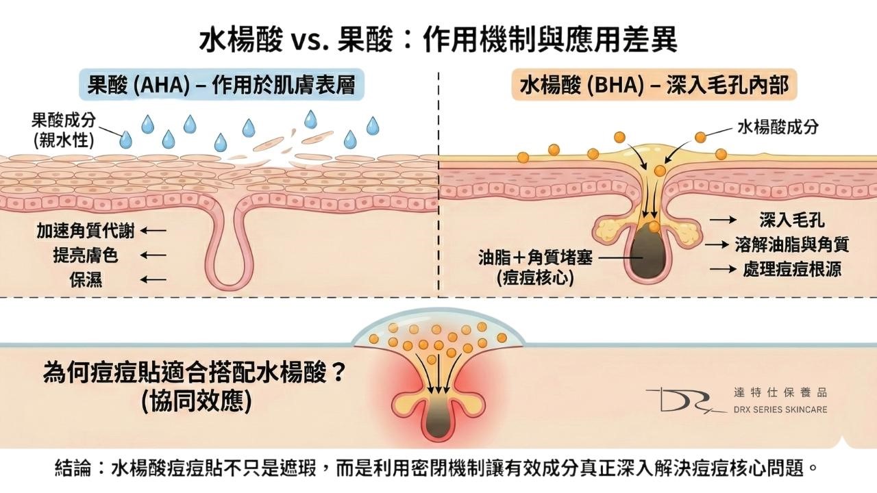 最近，還多了一種進化版本：把水楊酸直接加進痘痘貼裡。這樣對於青春痘有幫助嗎？這篇文章跟你說！