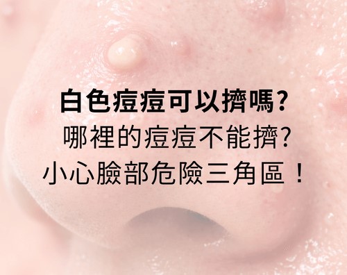 白色痘痘可以擠嗎？哪裡的痘痘不能擠？小心臉部危險三角區！