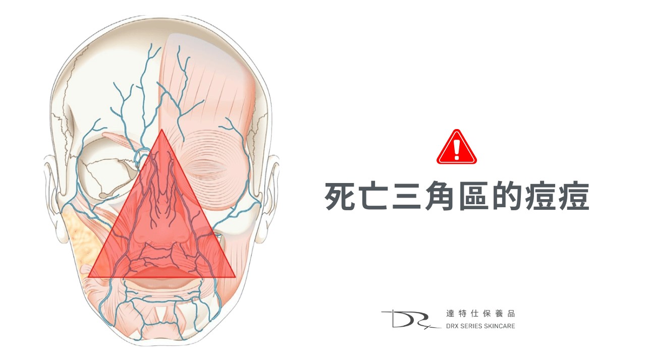 白色痘痘可以擠嗎？哪裡的痘痘不能擠？小心臉部危險三角區！