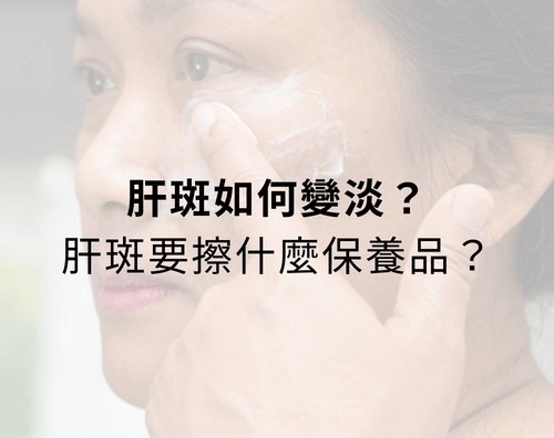 肝斑如何變淡?肝斑要擦什麼保養品? 肝斑如何變淡?肝斑要擦什麼保養品?