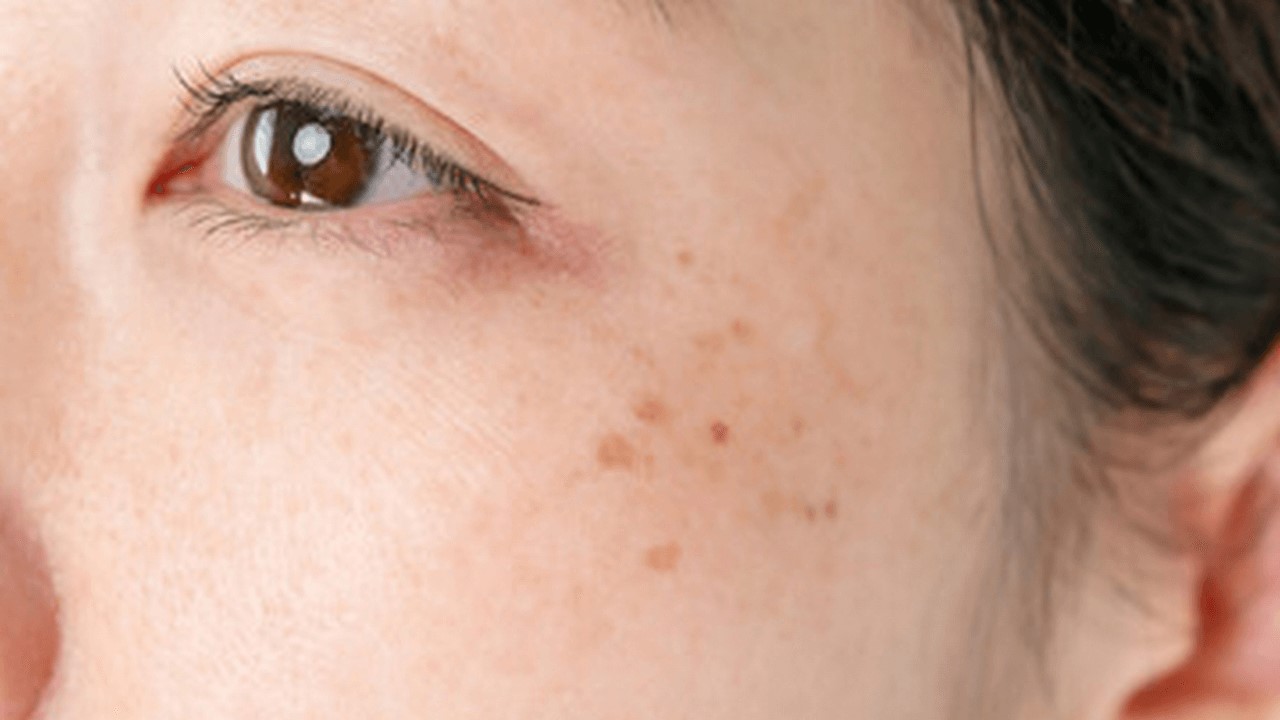 傳明酸、菸鹼醯胺一起用？韓國anua 美白精華液為何爆紅？