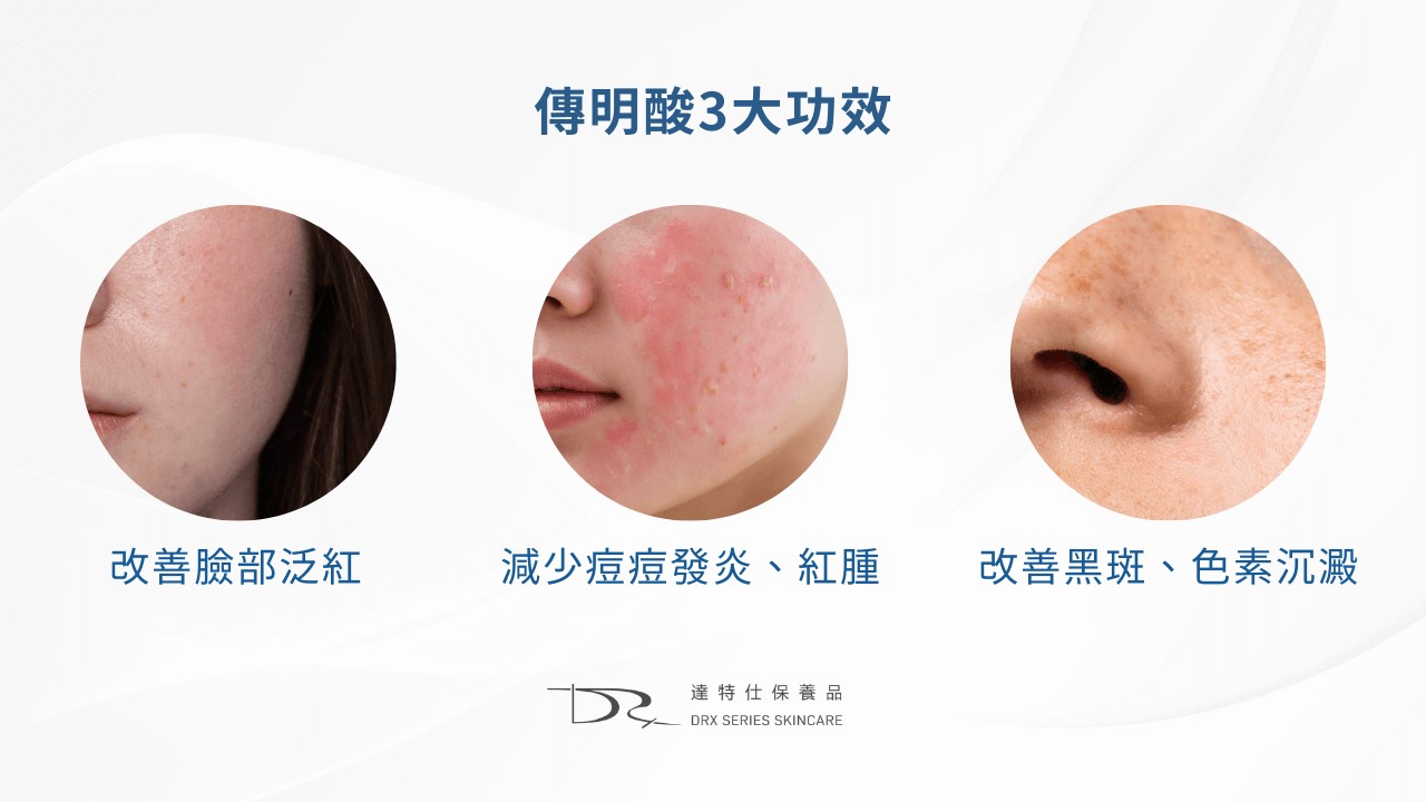 傳明酸、菸鹼醯胺一起用？韓國anua 美白精華液為何爆紅？