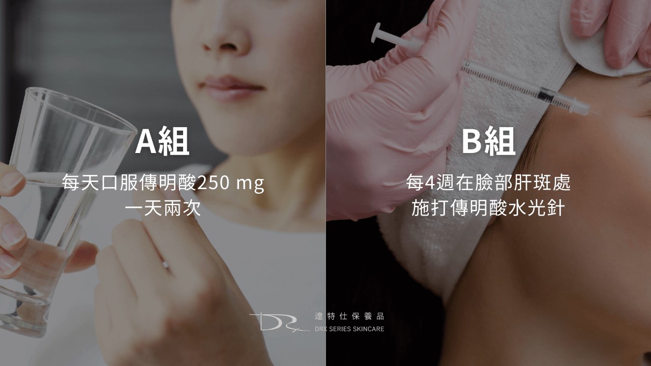 美白錠要吃多久才有效？ 傳明酸口服、穀胱甘肽點滴、美白針與口服維他命C美白完整攻略！