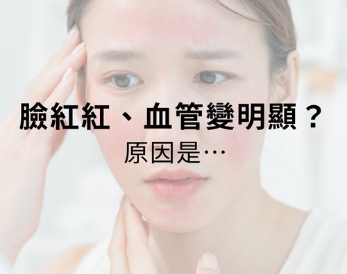 照鏡子總覺得臉上紅紅的一絲絲？為什麼臉上的血管越來越明顯？