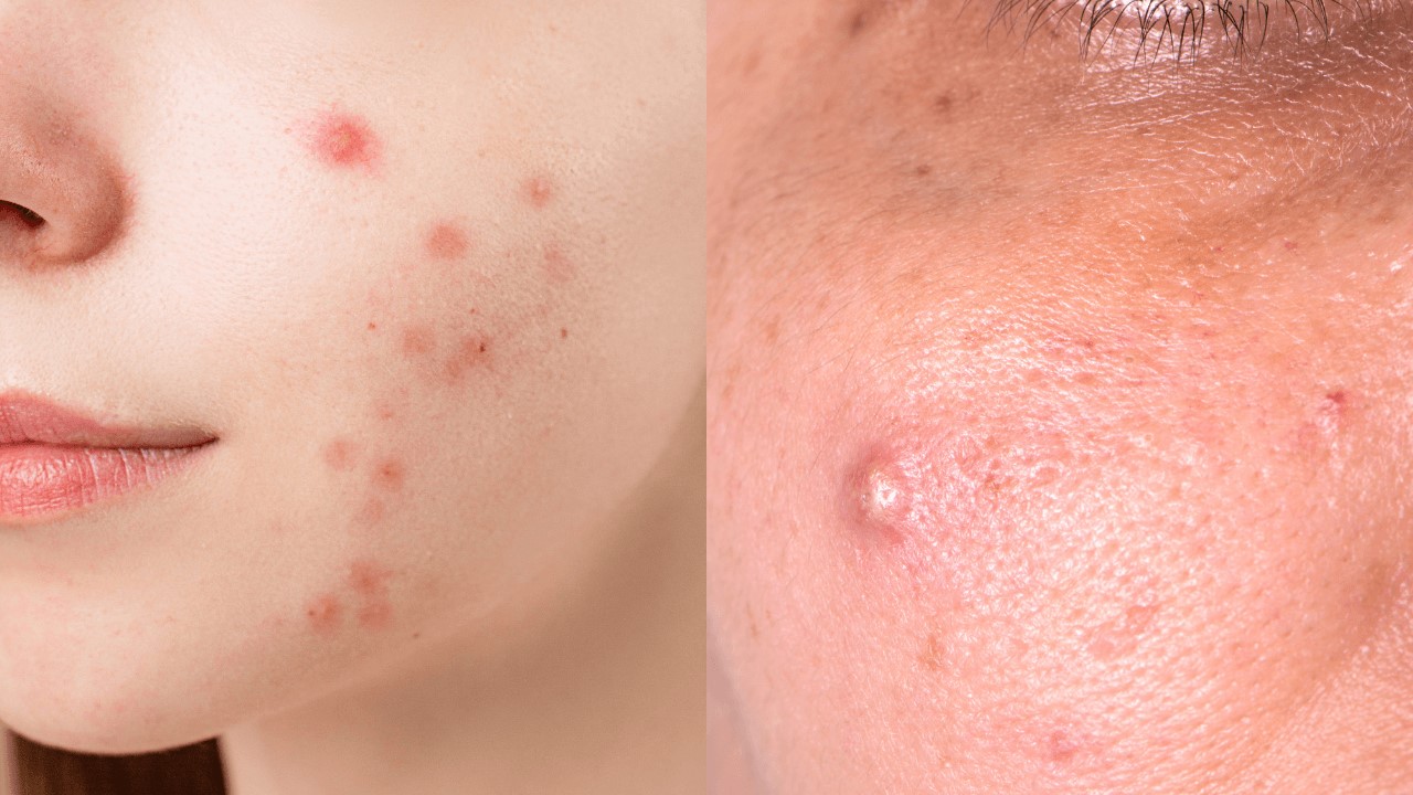 卸妝產品有哪些?卸妝產品怎麼選? 卸妝產品有哪些?卸妝產品怎麼選?