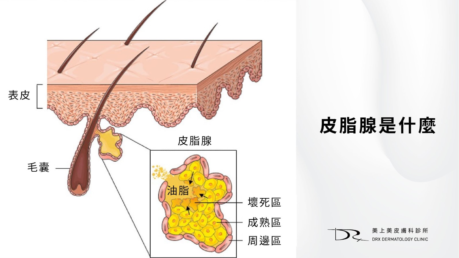 2026水楊酸功效完整解說：水楊酸會縮毛孔嗎? 水楊酸痘痘、水楊酸淡疤，果酸水楊酸差異一次搞懂！