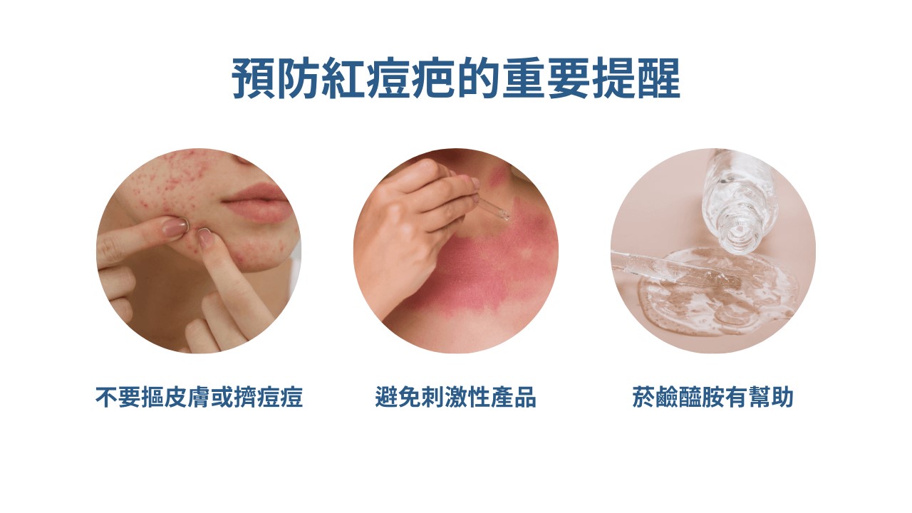 杜鵑花酸、A酸一起用：思媚乳膏用法、思麗安乳膏淡斑?紅痘疤杜鵑花酸保養方式！