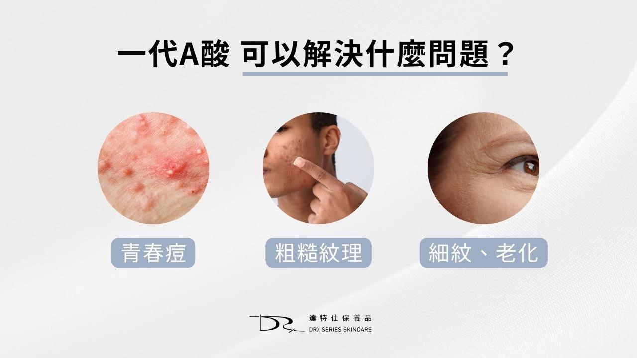 一代a酸特蒂樂乳膏效果？一代A酸抗老嗎？