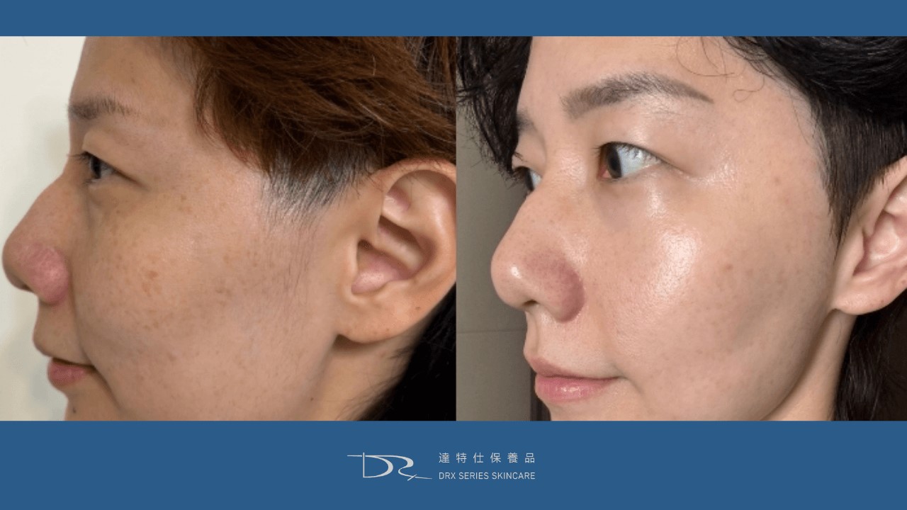 抗老最有效成分？30歲40歲抗老保養品？如何淡斑最有效？