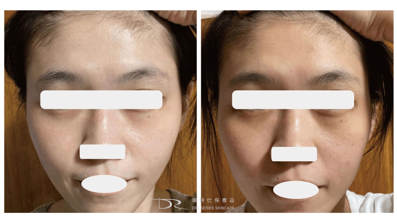 抗老最有效成分？30歲40歲抗老保養品？如何淡斑最有效？